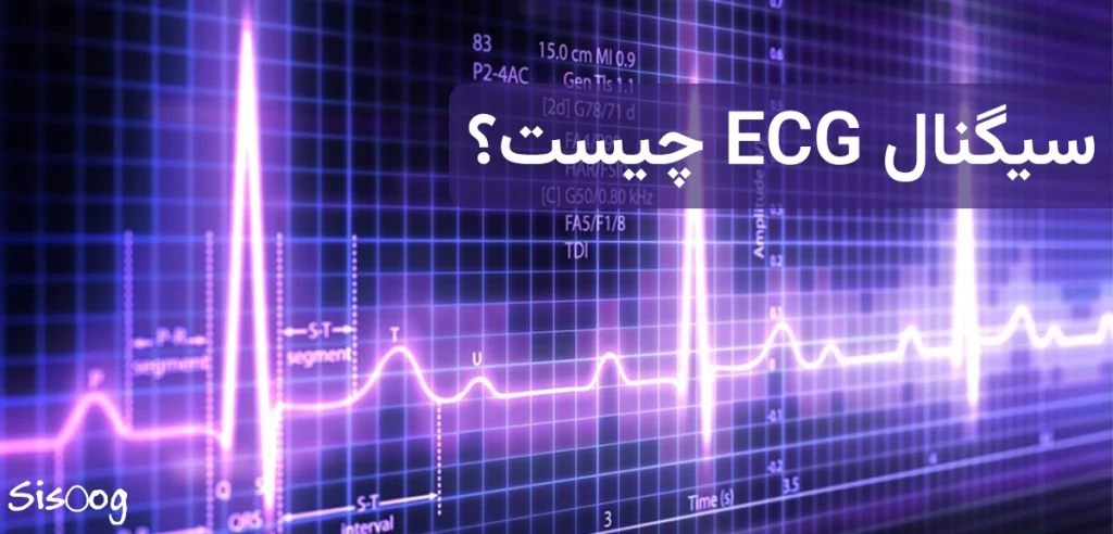 سیگنال ECG چیست؟