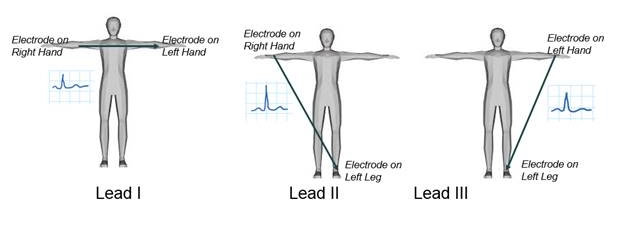 الکتروکاردیوگرام (Electrocardiogram) یا سیگنال ecg چیست؟